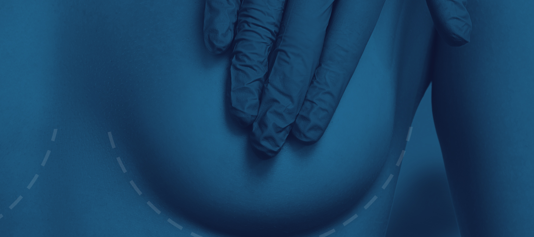 top breast surgeons nj nyc